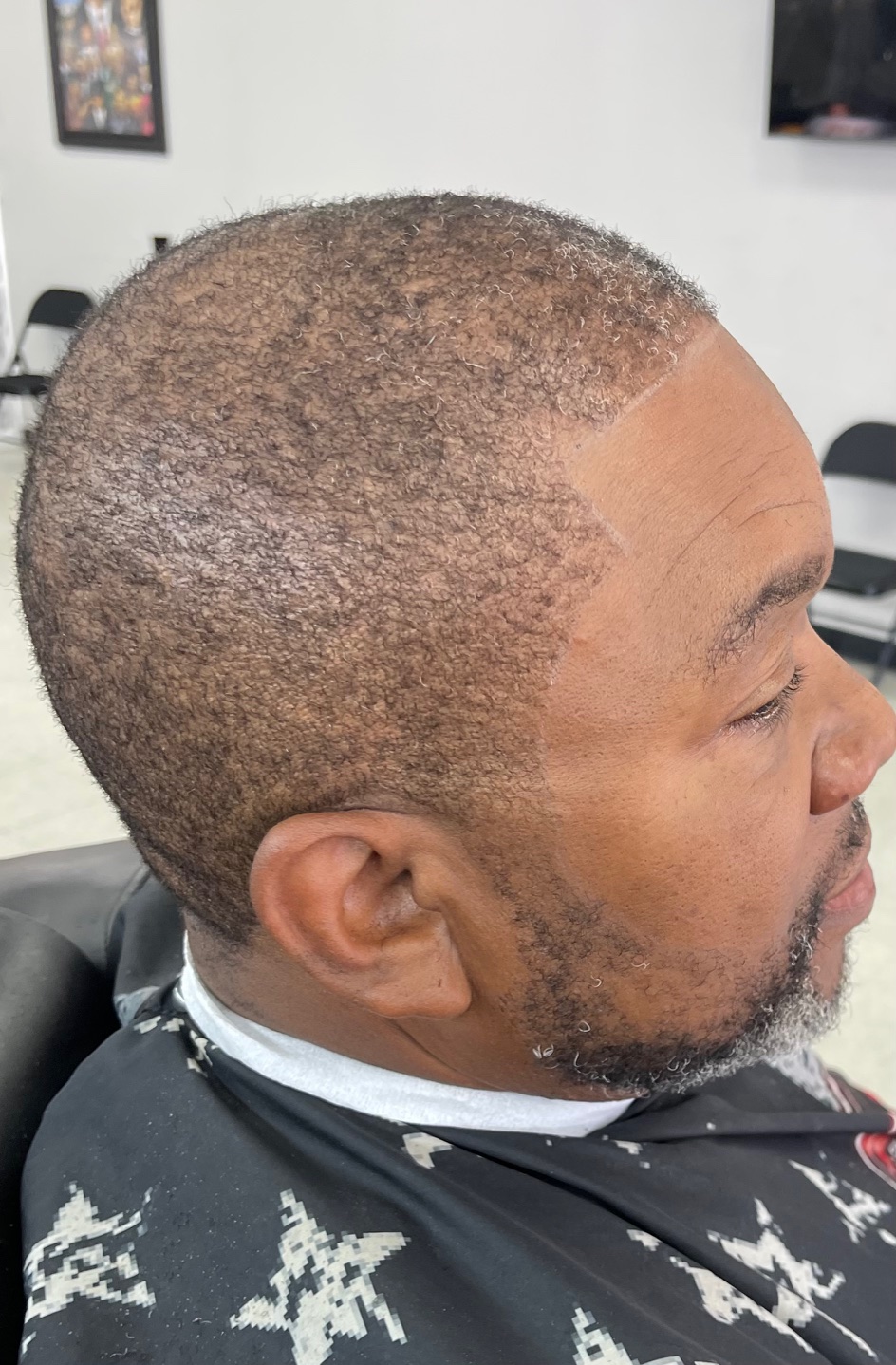 Bald fade with sharp lineup on textured top